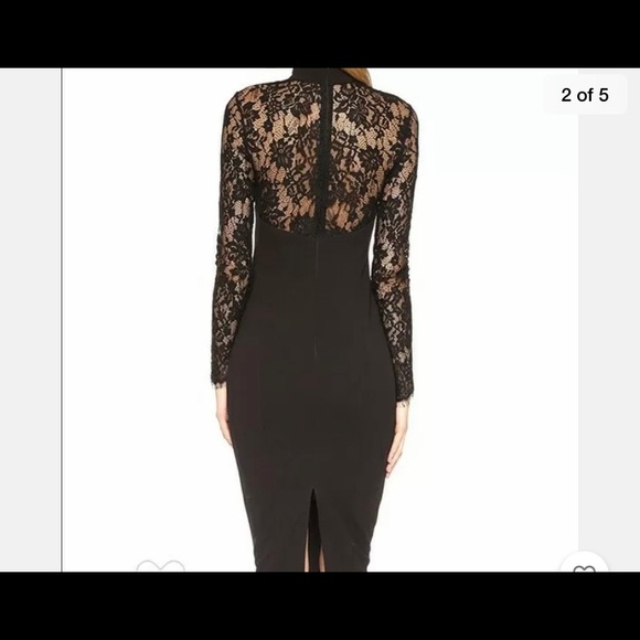 (NWT) Misha Collection Lace Dress - XS - Picture 3 of 8